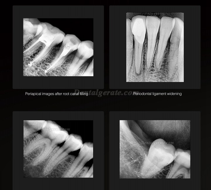 Runyes DR730 / DS750 Dental Digitaler Intraorale R&ouml;ntgensensor